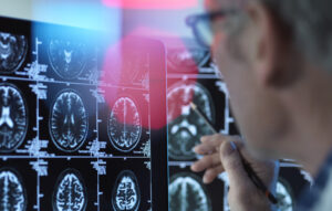 Doctor discovering how strength training improves memory, supports the hippocampus, increases Brain-Derived Neurotrophic Factor (BDNF), and helps protect the brain as we age